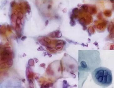 (li)ϴӣךWM(jn)ھϴOꑌҼ